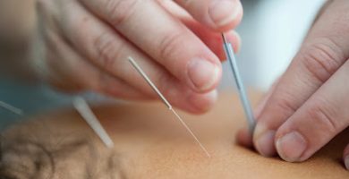 Acupuncture for Wellbeing