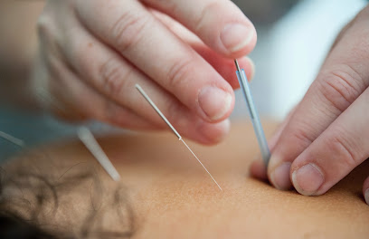 Acupuncture for Wellbeing