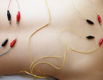 AMP Acupuncture & Medical Practice - Electroacupuncture