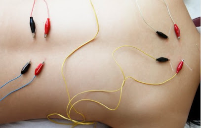 AMP Acupuncture & Medical Practice - Electroacupuncture