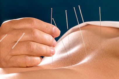 Elk Grove Acupuncture