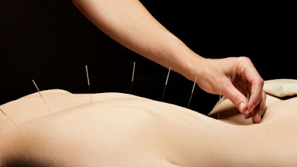 Acupuncture Miami