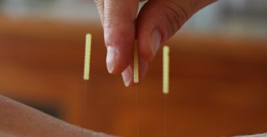 2 the Point Acupuncture