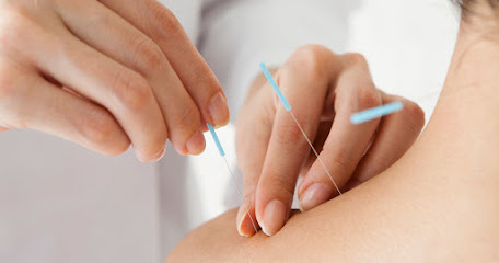 OC Acupuncture Treatment Center