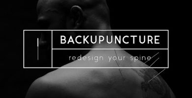 Backupuncture of Denver