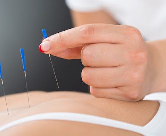 WholeSelf Acupuncture and Chinese Herbal Medicine