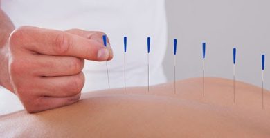 Oriental Acupuncture