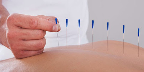 Oriental Acupuncture