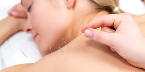 TRUE LA Acupuncture & Wellness