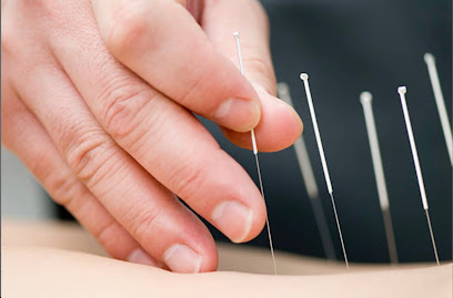 Redwood Acupuncture