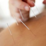 Santa Ana Acupuncture