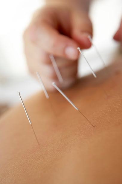 Santa Ana Acupuncture