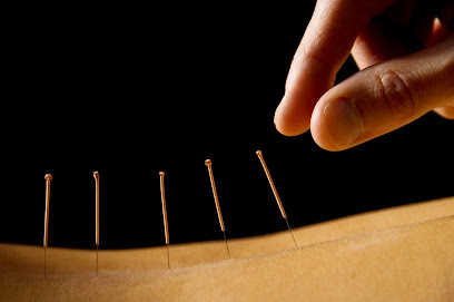 Kim Vandeveer Acupuncture