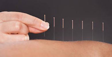 Helios Acupuncture Clinic