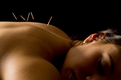 Tucson Acupuncture and Chinese Herbs