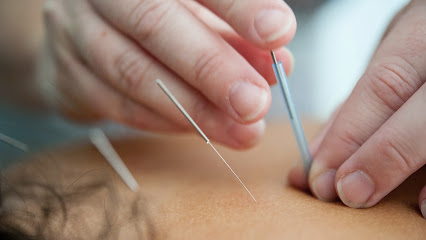 ABC Acupuncture