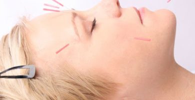 American Acupuncture