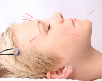 American Acupuncture