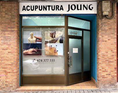 Acupuntura Joung