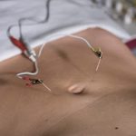 ACUPUNTURA Y NATUROPATÍA Poblenou Laura Piñol