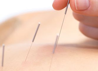 Acupunctura Dr Cai